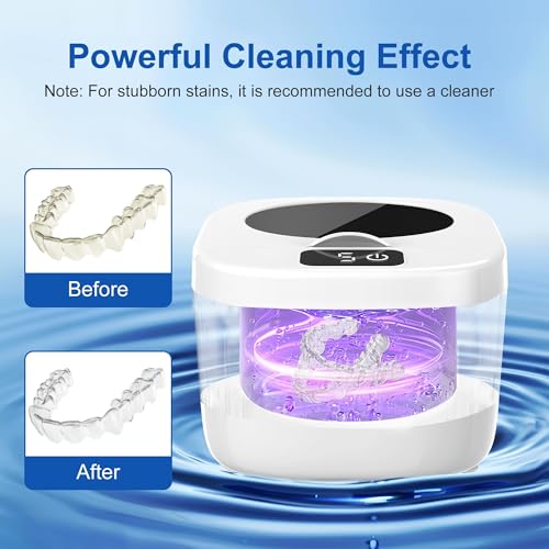 Professional Ultrasonic Retainer Cleaner Retainer Cleaning Machine - 45kHz Ultrasonic Cleaning, Suitable for Denture Mouth Guard Aligner Dental Trays
