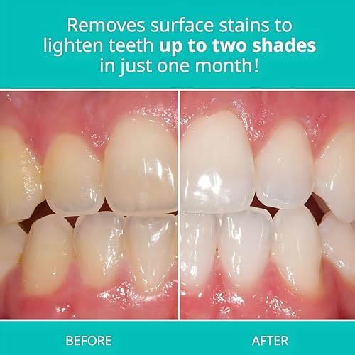 Opalescence Whitening Toothpaste Travel Size 1 Ounce (2 Pack) Fluoride Teeth Whitening Toothpaste, Mint Flavor 402-2