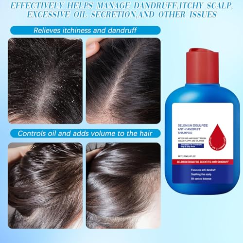 Nippori Anti-Dandruff Shampoo, Oil Control Formula for Men and Women, 300ml