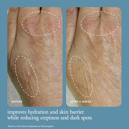 philosophy in good hands multi-restorative hand cream - with vitamin C & niacinamide - plumps & smoothes crepey skin - reduces the appearance of dark spots - transfer-proof & non-greasy formula