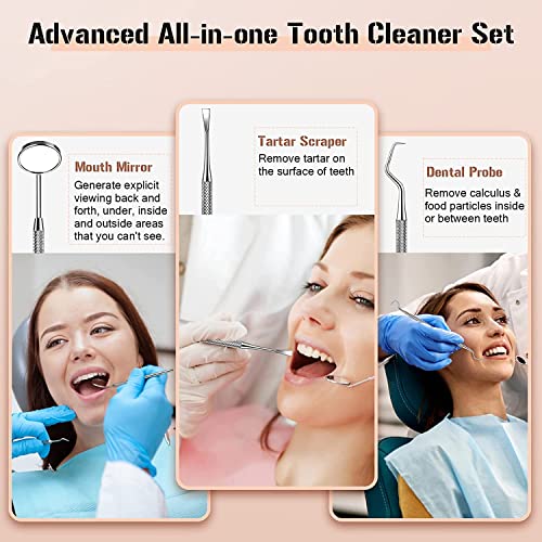 Plaque Remover for Teeth, Electric Tooth Cleaner Tartar Remover for Teeth with LED Light,4 Modes Rechargeable Teeth Cleaning Kit with Dental Tools, 2 Replaceable Heads (White A)